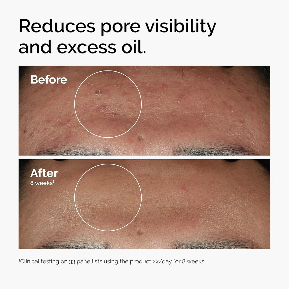 The Ordinary Niacinamide Smoothing Serum