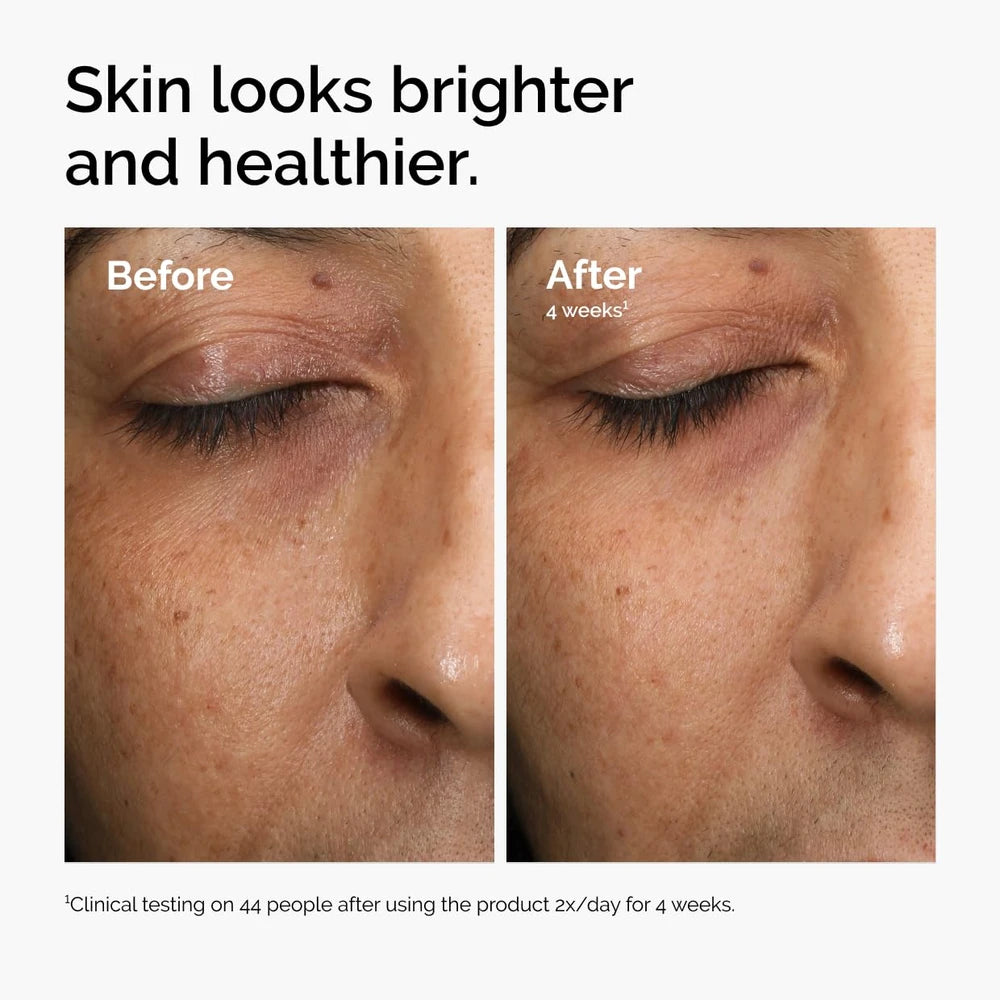 Vitamin C Radiance Serum